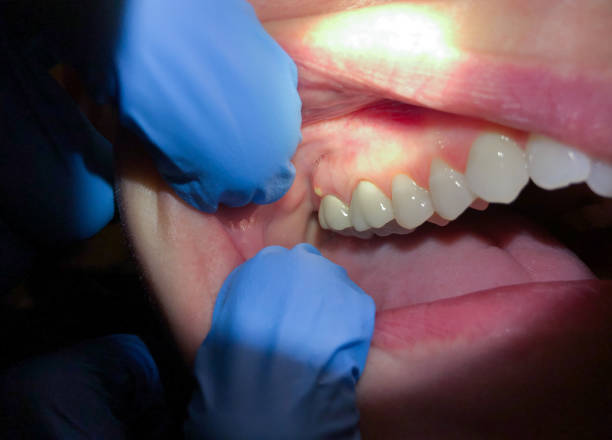 Professional Emergency Dental Service in WV